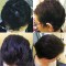 Sistema Capelli - Reduz a queda de cabelo na quimioterapia